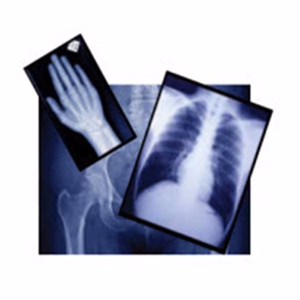 X-Ray Film